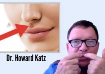 Botox Injection under the Nose