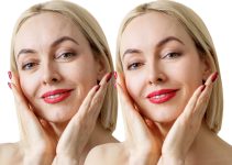 Botox for Novices: The Comprehensive Guide to the Contemporary Cosmetic Procedure