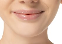 Smoothing Perioral Wrinkles with Dermal Fillers