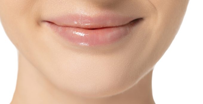 Smoothing Perioral Wrinkles with Dermal Fillers